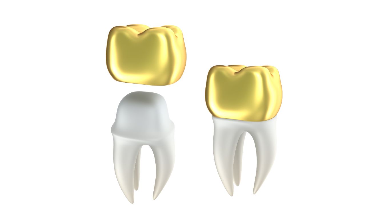 golden dental crown
